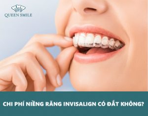 chi-phi-nieng-rang-invisalign