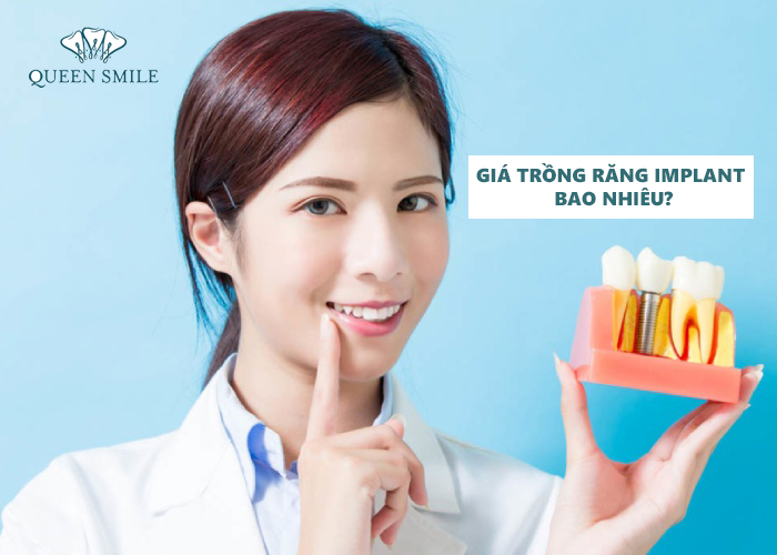 gia-trong-rang-implant