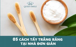 cach-tay-trang-rang-tai-nha