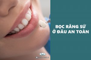 boc-rang-su-o-dau-an-toan-1