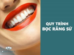 cac-buoc-boc-rang-su