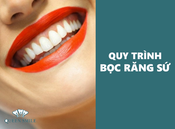 cac-buoc-boc-rang-su