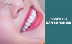 uu-diem-cua-dan-rang-su