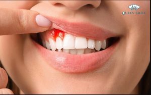 boc-rang-su-bi-viem-loi