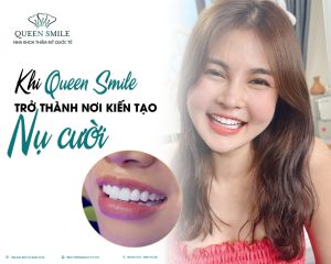 dia-chi-boc-rang-su-dep-o-ha-noi