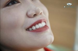 boc-rang-su-bao-nhieu-tien-1-chiec