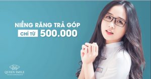 co-nen-nieng-rang-tra-gop-khong