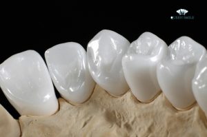 rang-su-dung-duoc-bao-lau